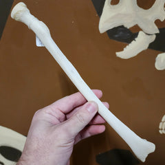 Human Radius Bone