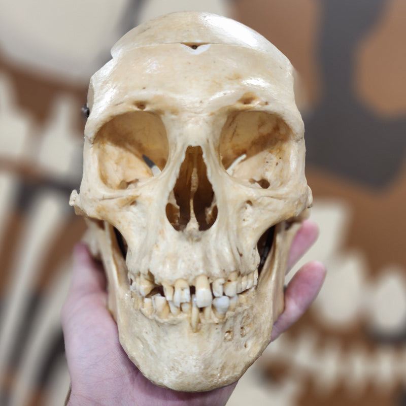 Human Skull, Damaged Calvaria