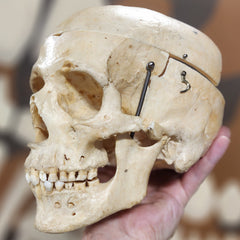 Human Skull, Damaged Calvaria