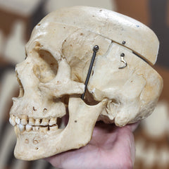 Human Skull, Damaged Calvaria