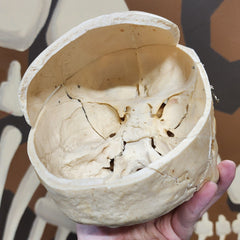 Human Skull, Damaged Calvaria